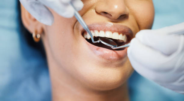 Best Broken or Chipped Tooth Repair in Mather, CA
