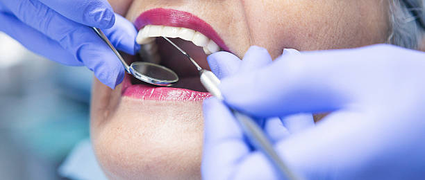 Best Urgent Dental Care for Toothaches in Mather, CA